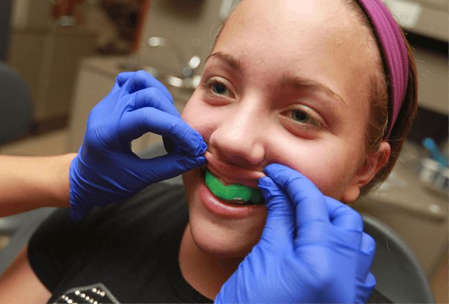 Mouth Guard