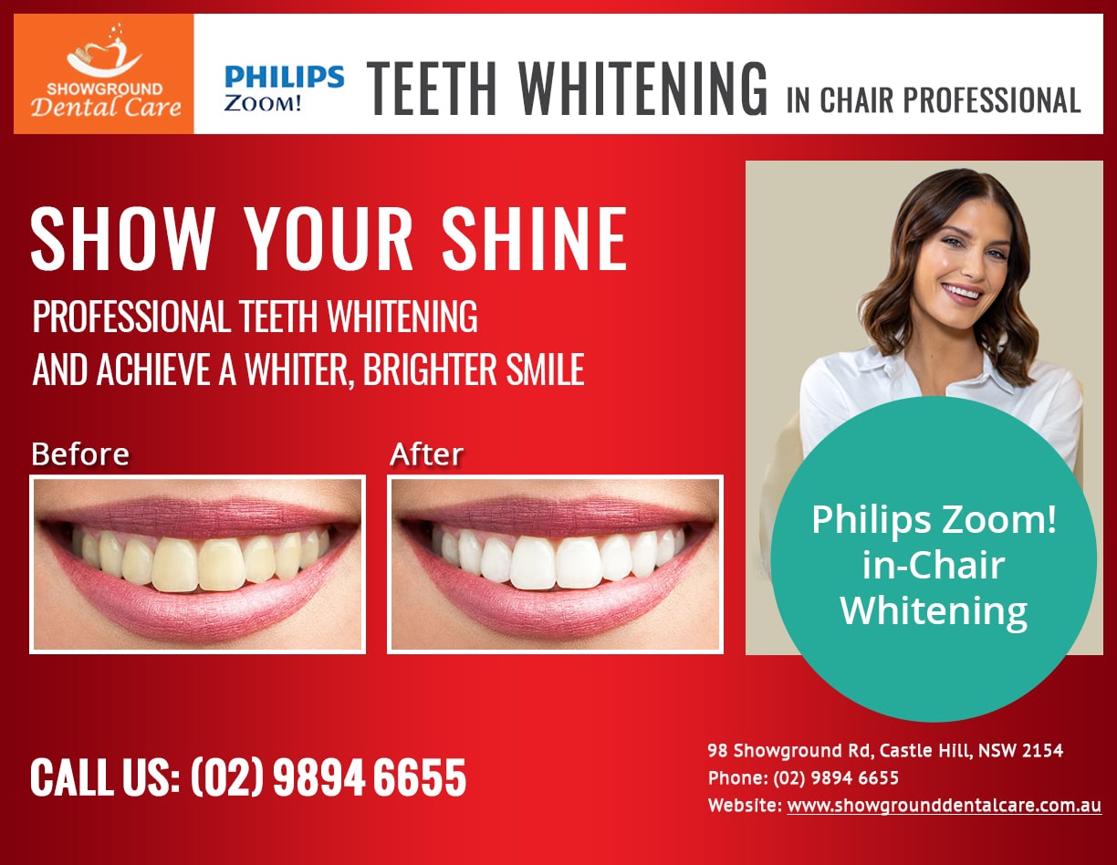 Teeth Whitening promo